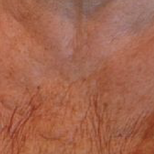 ANTES